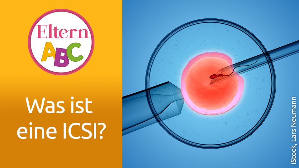 Kinderwunschbehandlung: ICSI: Chancen und Risiken der Intrazytoplasmatischen Spermieninjektion