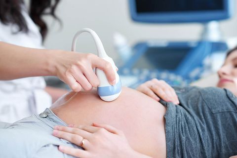 Ultraschall-Untersuchung einer Schwangeren