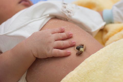 Bauchnabel: Das Wichtigste zur Nabelpflege bei Neugeborenen